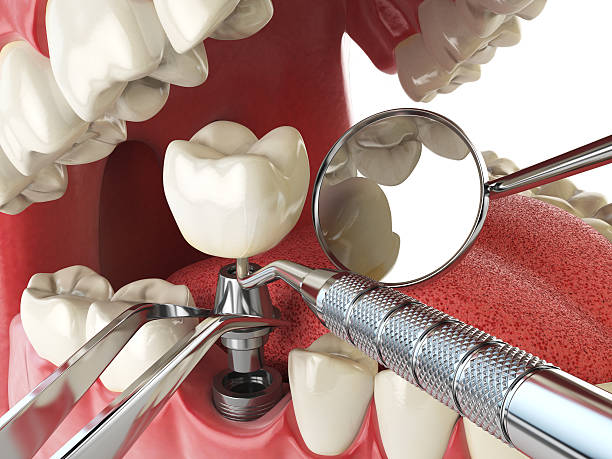 Best Emergency Denture Repair in Cimarron, KS